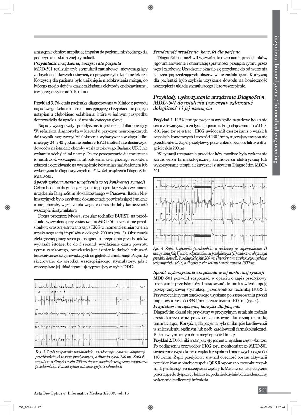 Korzyścią dla pacjenta było uniknięcie niedokrwienia mózgu, do którego mogło dojść w czasie zakładania elektrody endokawitarnej, trwającego zwykle od 5-10 minut. Przykład 3.
