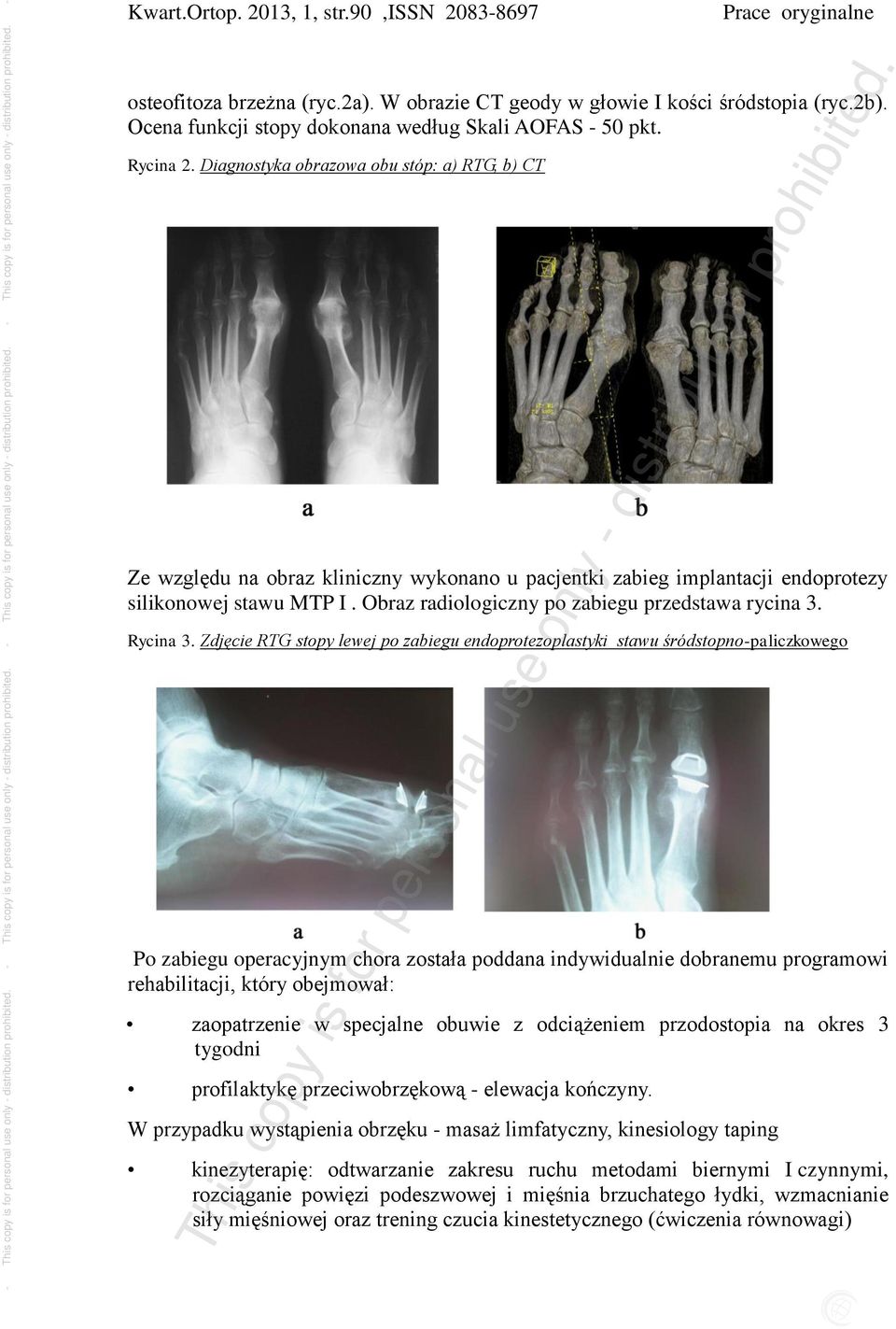Obraz radiologiczny po zabiegu przedstawa rycina 3. Rycina 3.