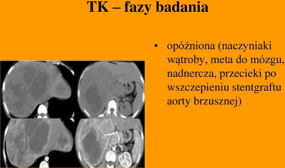 mózgu, nadnercza, przecieki po