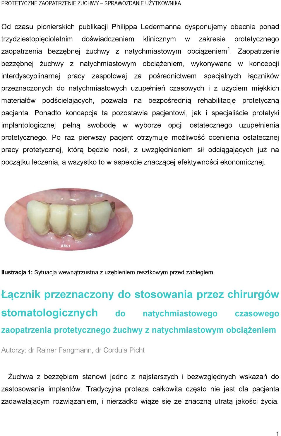 Zaopatrzenie bezzębnej żuchwy z natychmiastowym obciążeniem, wykonywane w koncepcji interdyscyplinarnej pracy zespołowej za pośrednictwem specjalnych łączników przeznaczonych do natychmiastowych