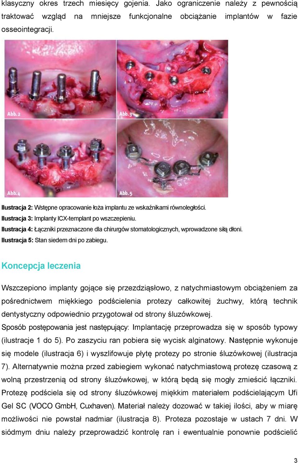 Ilustracja 4: Łączniki przeznaczone dla chirurgów stomatologicznych, wprowadzone siłą dłoni. Ilustracja 5: Stan siedem dni po zabiegu.