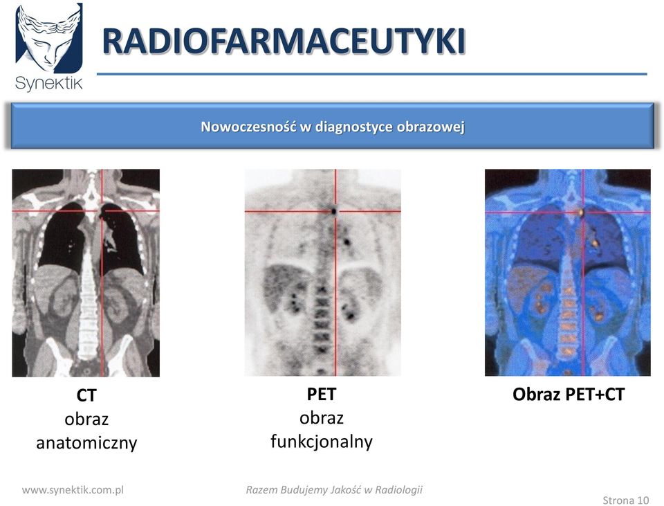 obraz anatomiczny PET obraz