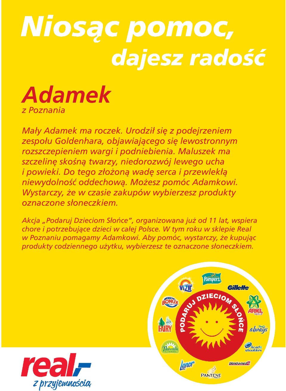 podniebienia. Maluszek ma szczelinę skośną twarzy, niedorozwój lewego ucha i powieki.