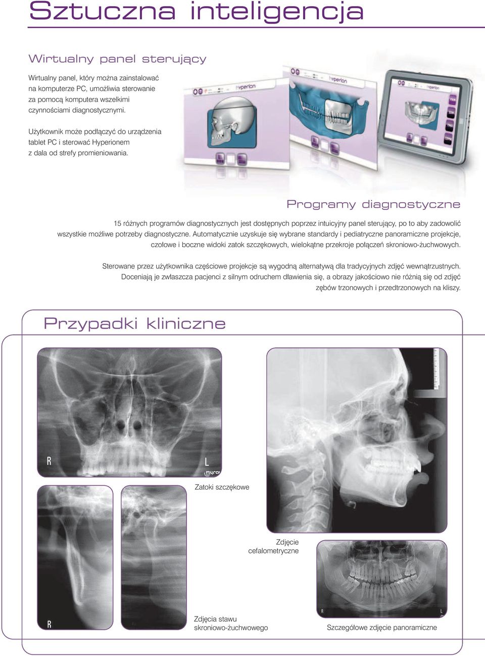Programy diagnostyczne 15 ró nych programów diagnostycznych jest dost pnych poprzez intuicyjny panel sterujàcy, po to aby zadowoliç wszystkie mo liwe potrzeby diagnostyczne.