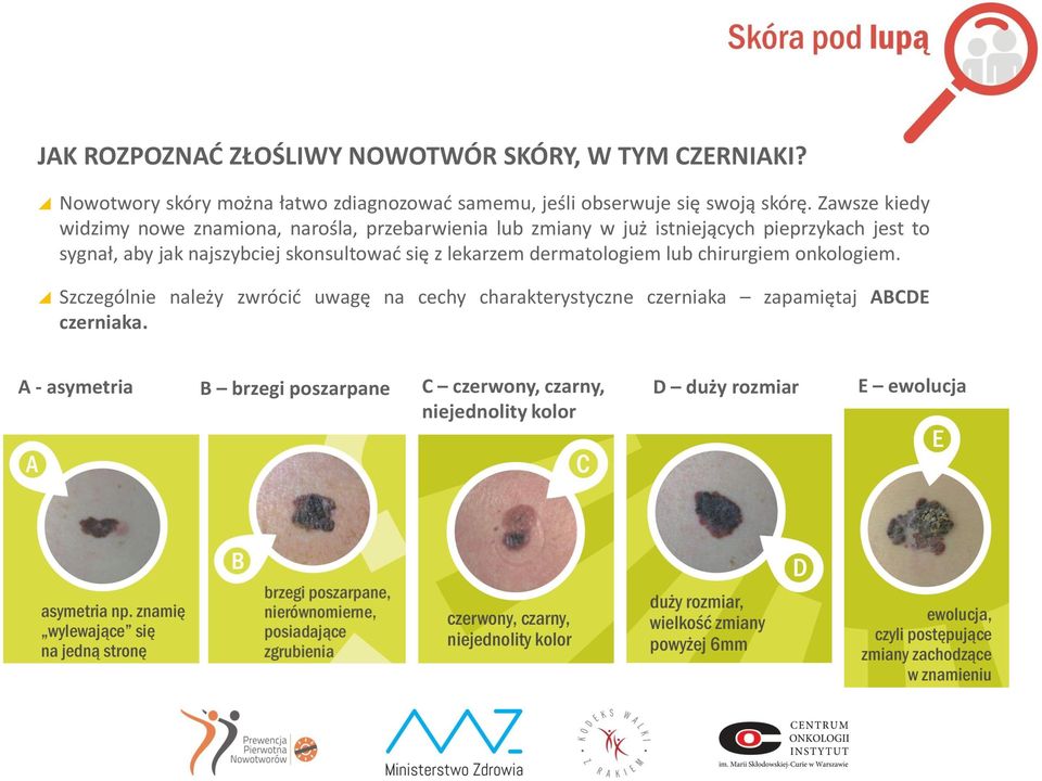 Zawsze kiedy widzimy nowe znamiona, narośla, przebarwienia lub zmiany w już istniejących pieprzykach jest to sygnał, aby jak