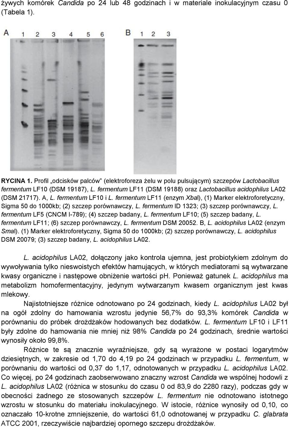 fermentum LF10 i L. fermentum LF11 (enzym Xbal), (1) Marker elektroforetyczny, Sigma 50 do 1000kb; (2) szczep porównawczy, L. fermentum ID 1323; (3) szczep porównawczy, L.