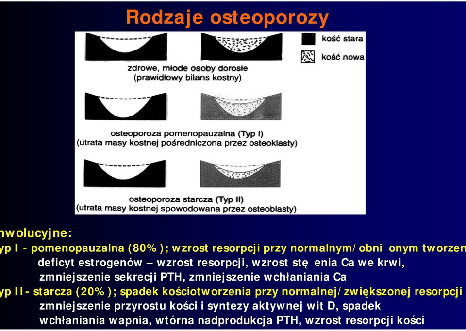 wchłaniania Ca yp II- starcza (20%); spadek kościotworzenia przy normalnej/zwiększonej resorpcji zmniejszenie