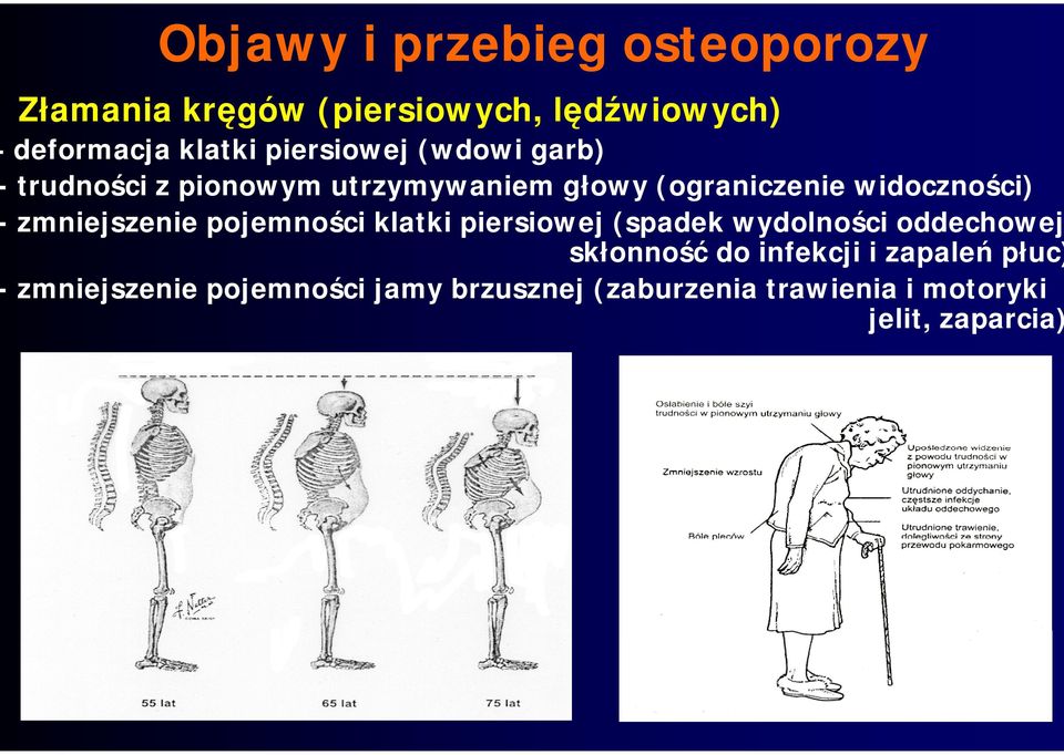 zmniejszenie pojemności klatki piersiowej (spadek wydolności oddechowej skłonność do infekcji i