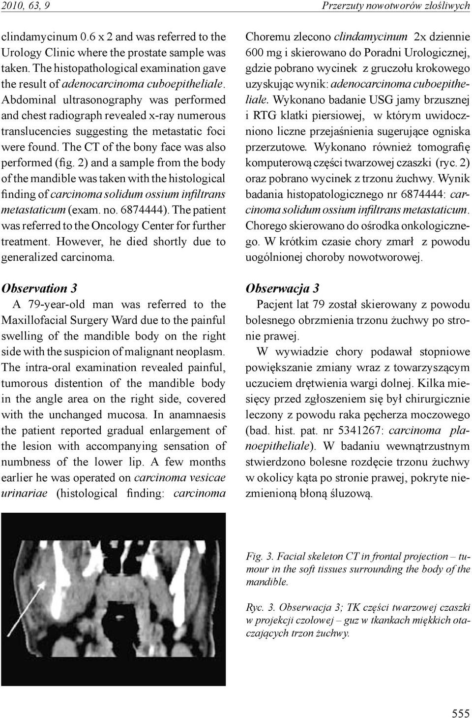 Abdominal ultrasonography was performed and chest radiograph revealed x-ray numerous translucencies suggesting the metastatic foci were found. The CT of the bony face was also performed (fig.