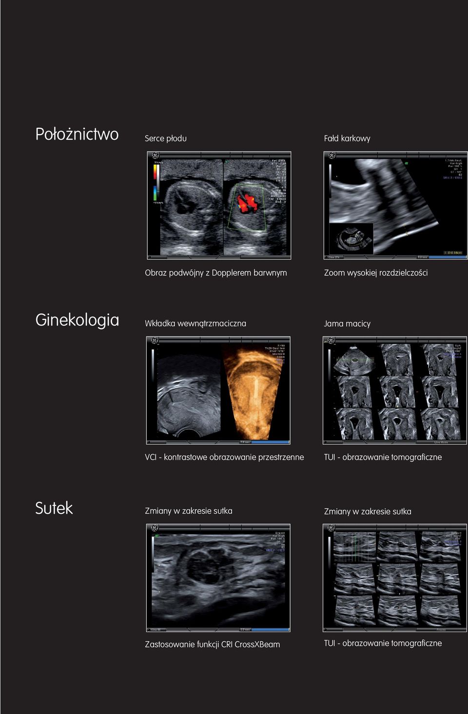 kontrastowe obrazowanie przestrzenne TUI - obrazowanie tomograficzne Zmiany w zakresie