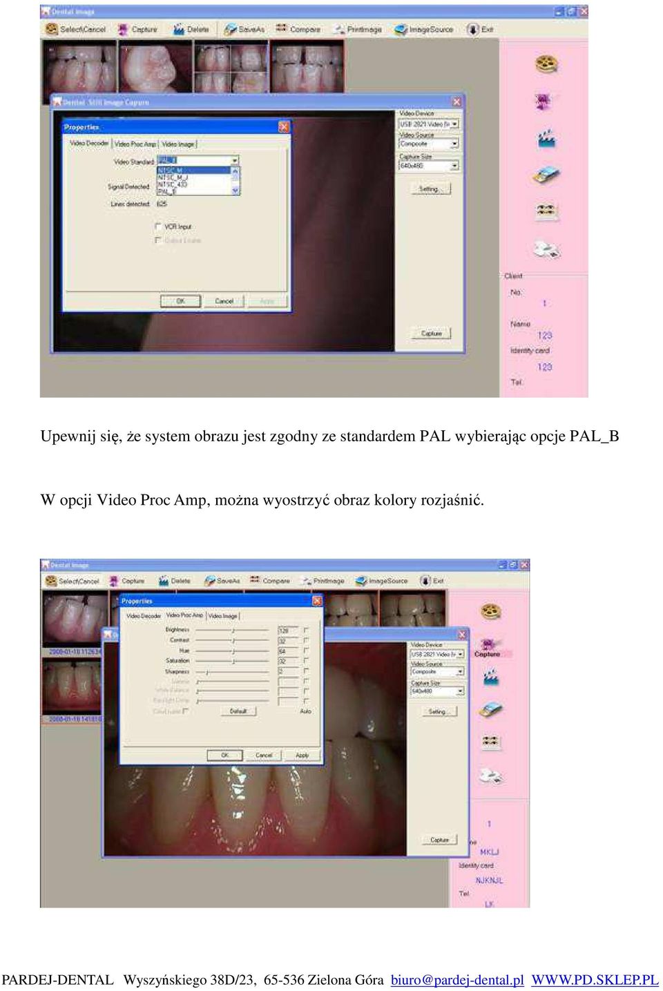 opcje PAL_B W opcji Video Proc Amp,