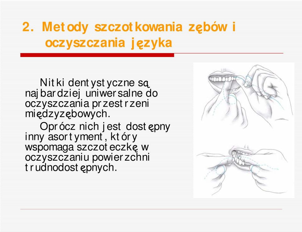 przestrzeni międzyzębowych.