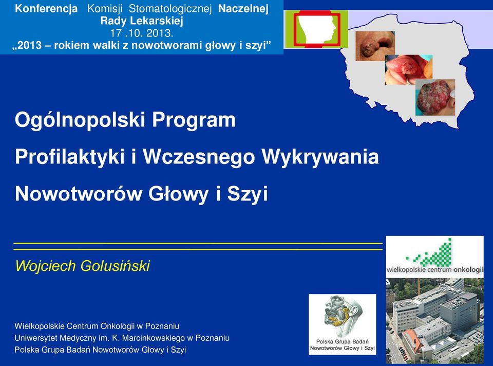 Wykrywania Nowotworów Głowy i Szyi Wojciech Golusiński Wielkopolskie Centrum Onkologii w