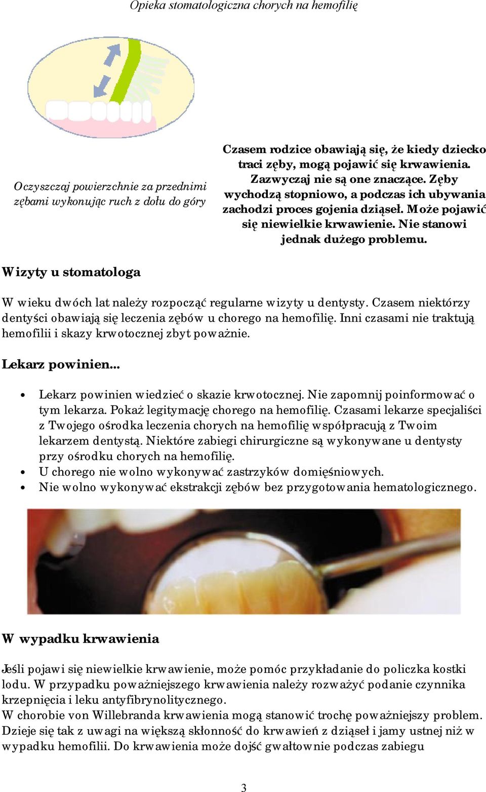 Wizyty u stomatologa W wieku dwóch lat należy rozpocząć regularne wizyty u dentysty. Czasem niektórzy dentyści obawiają się leczenia zębów u chorego na hemofilię.