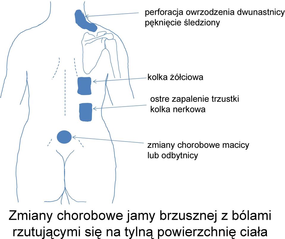 zmiany chorobowe macicy lub odbytnicy Zmiany chorobowe