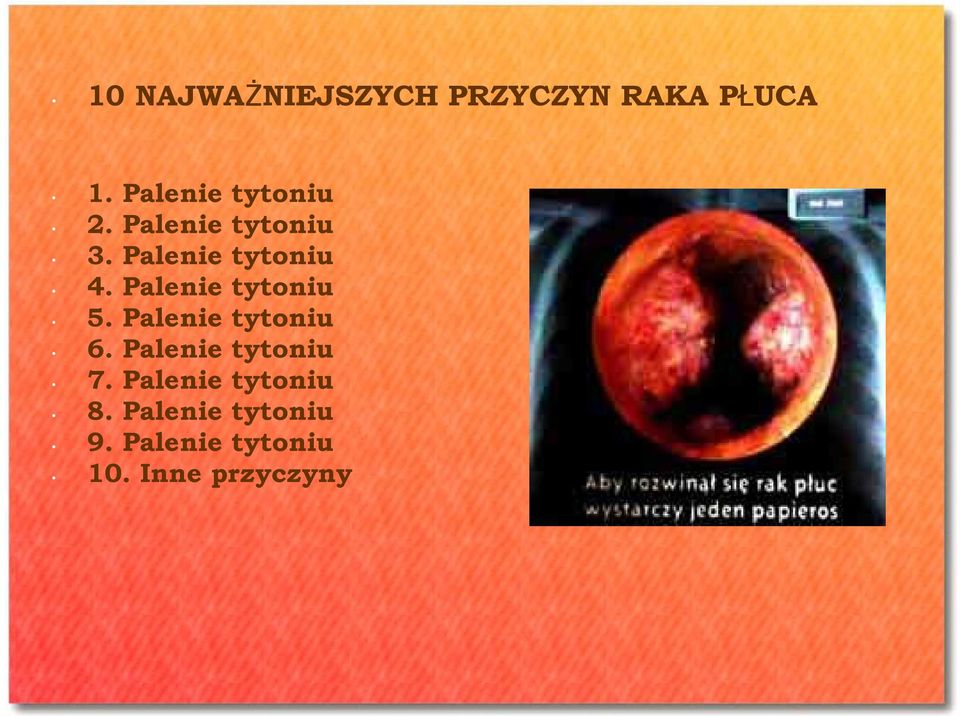 Palenie tytoniu 5. Palenie tytoniu 6. Palenie tytoniu 7.