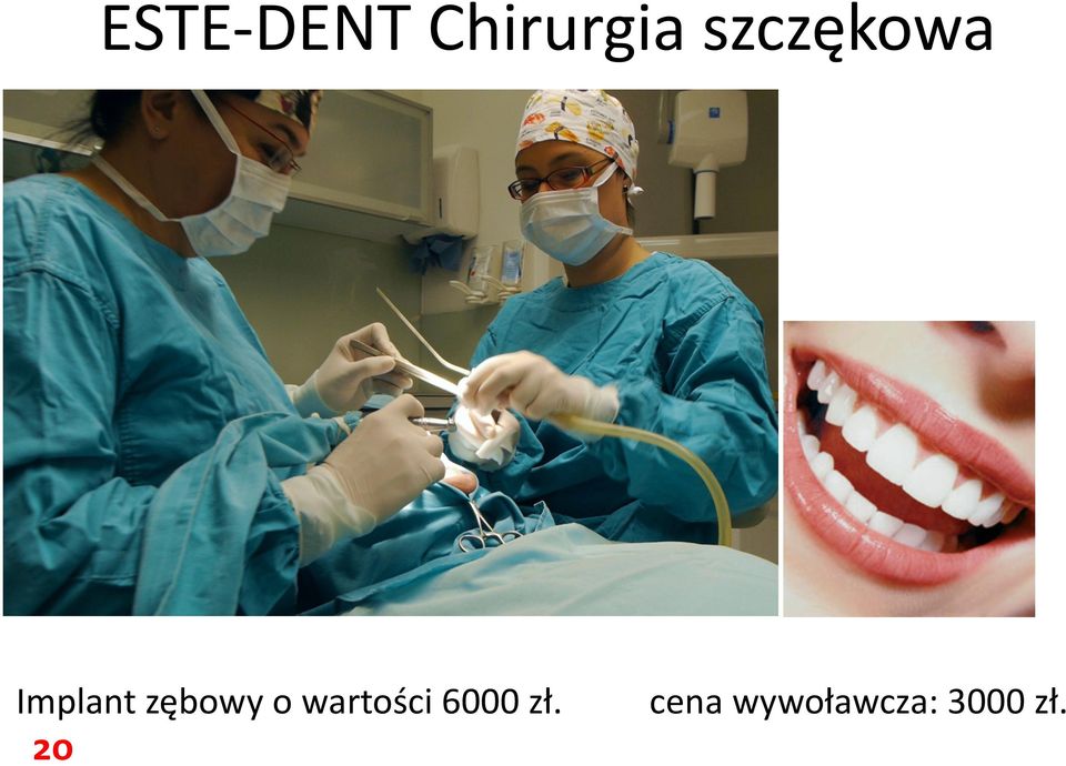 zębowy o wartości 6000