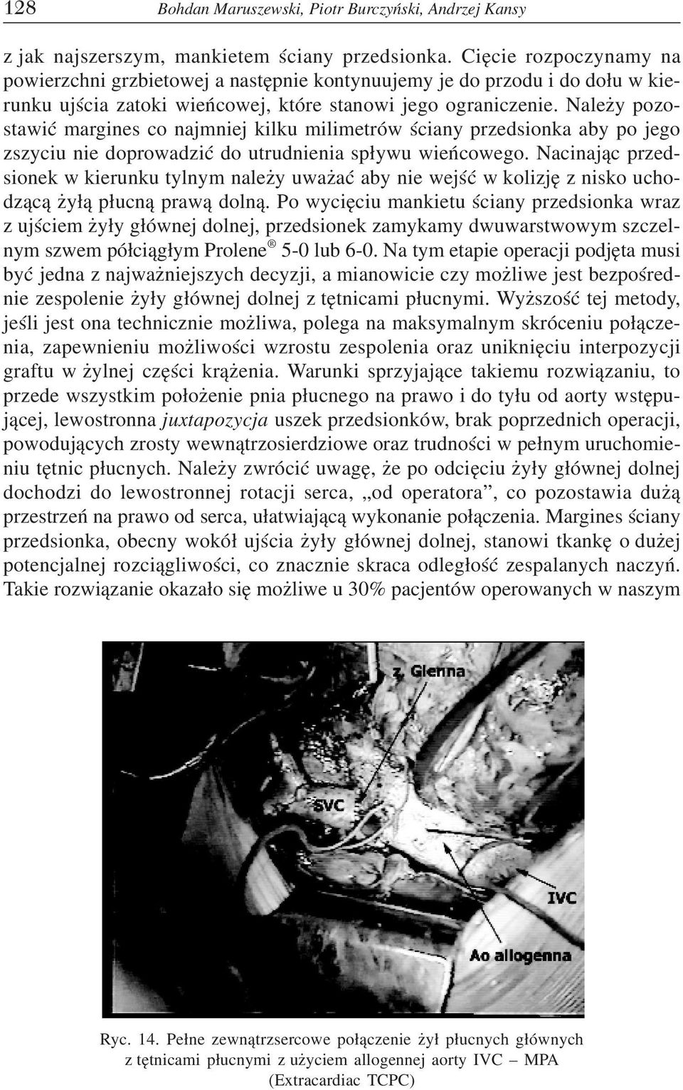 Należy pozo stawić margines co najmniej kilku milimetrów ściany przedsionka aby po jego zszyciu nie doprowadzić do utrudnienia spływu wieńcowego.