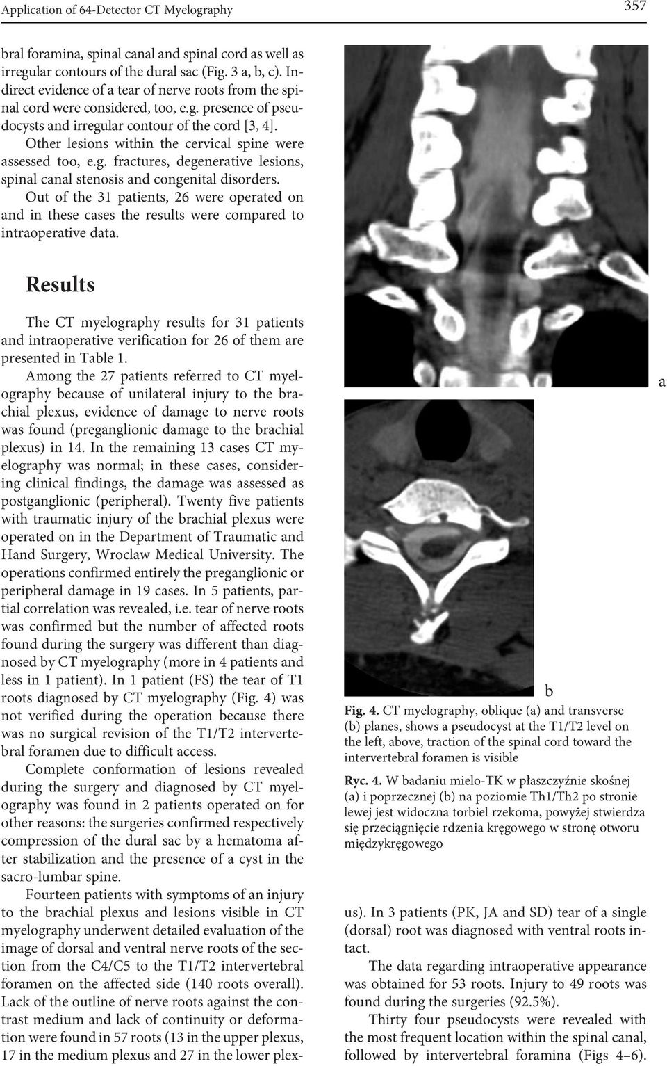 Other lesions within the cervicl spine were ssessed too, e.g. frctures, degenertive lesions, spinl cnl stenosis nd congenitl disorders.