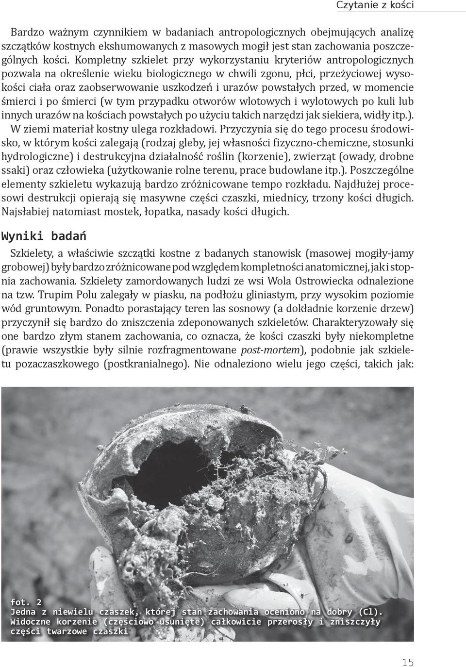 powstałych przed, w momencie śmierci i po śmierci (w tym przypadku otworów wlotowych i wylotowych po kuli lub innych urazów na kościach powstałych po użyciu takich narzędzi jak siekiera, widły itp.).