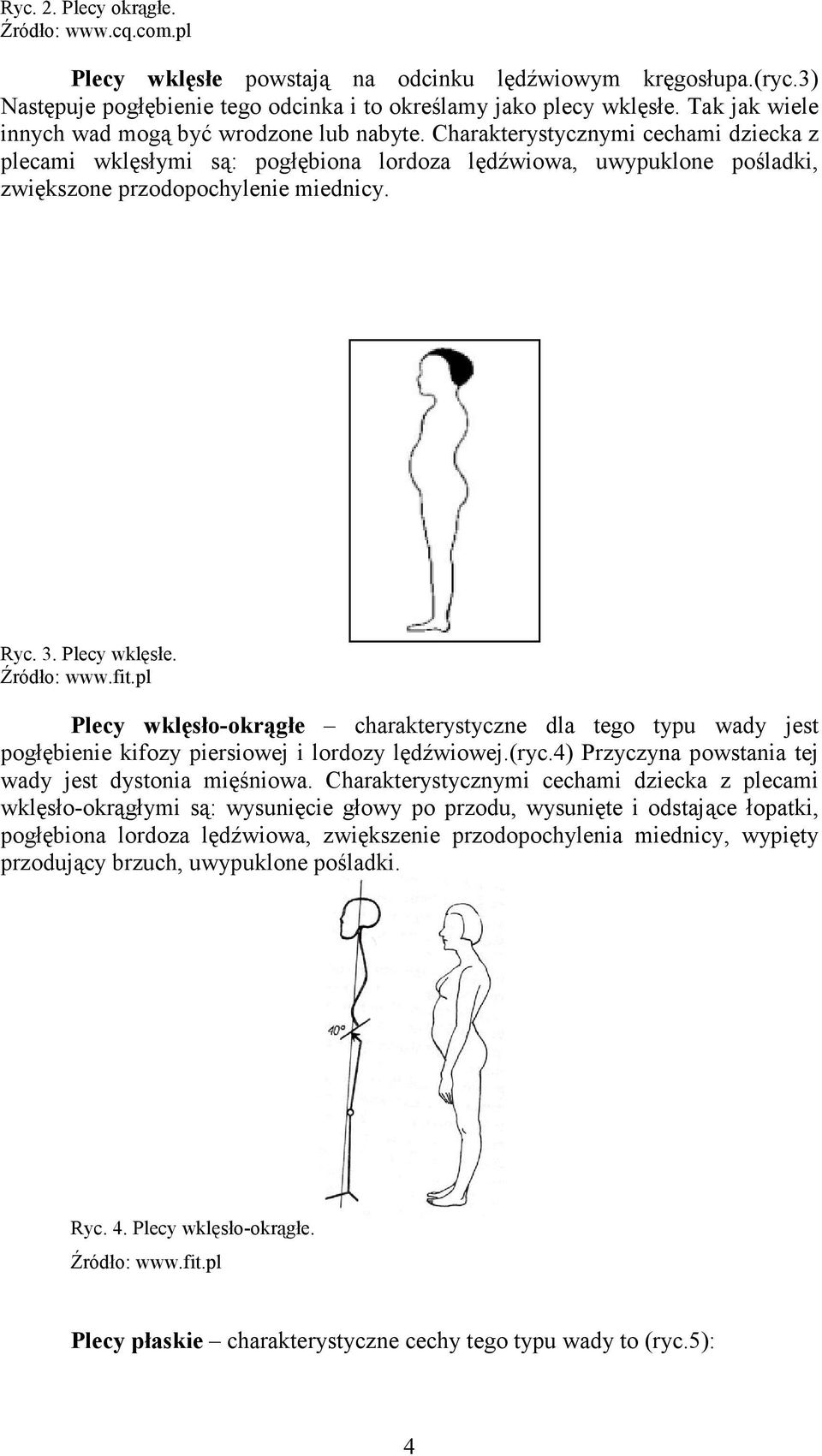 Charakterystycznymi cechami dziecka z plecami wklęsłymi są: pogłębiona lordoza lędźwiowa, uwypuklone pośladki, zwiększone przodopochylenie miednicy. Ryc. 3. Plecy wklęsłe. Źródło: www.fit.