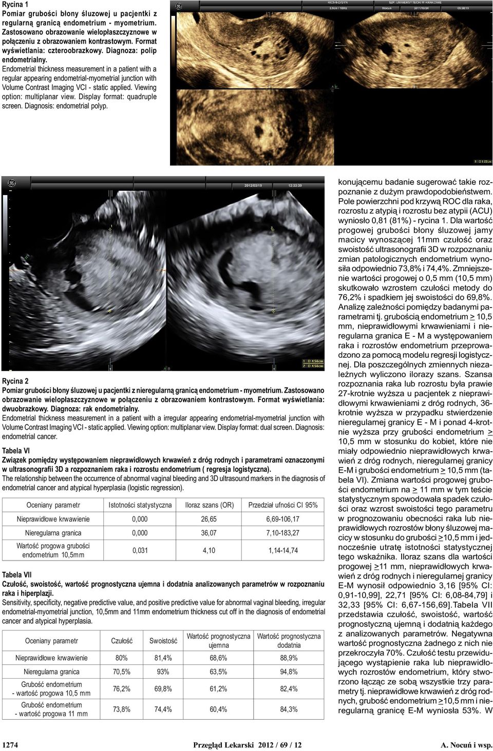 Endometrial thickness measurement in a patient with a regular appearing endometrial-myometrial junction with Volume Contrast Imaging VCI - static applied. Viewing option: multiplanar view.