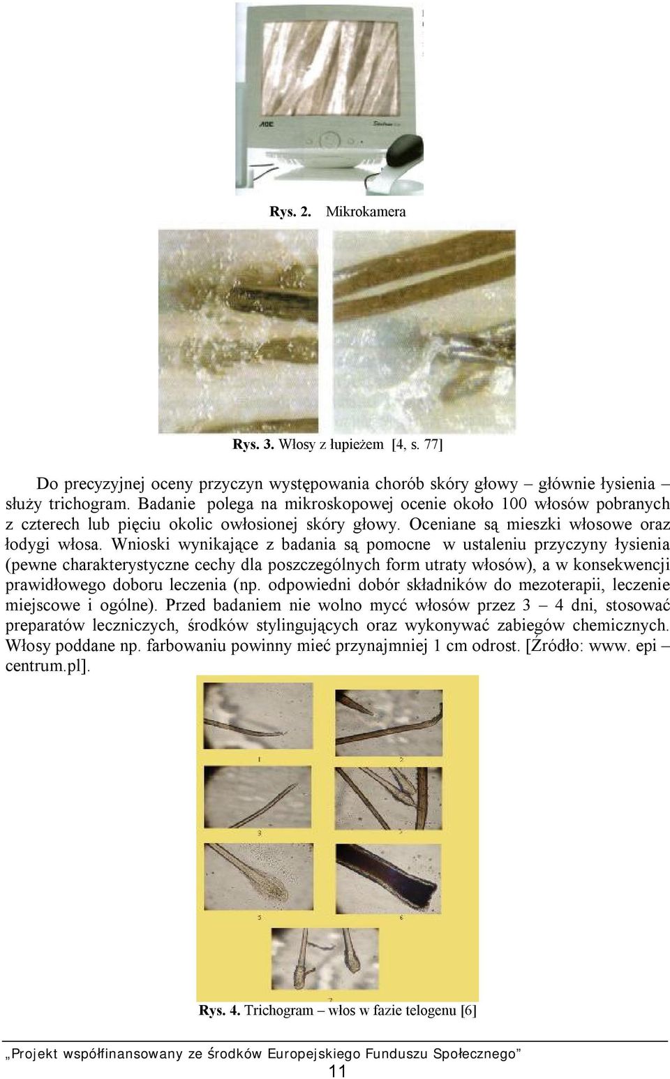 Wnioski wynikające z badania są pomocne w ustaleniu przyczyny łysienia (pewne charakterystyczne cechy dla poszczególnych form utraty włosów), a w konsekwencji prawidłowego doboru leczenia (np.