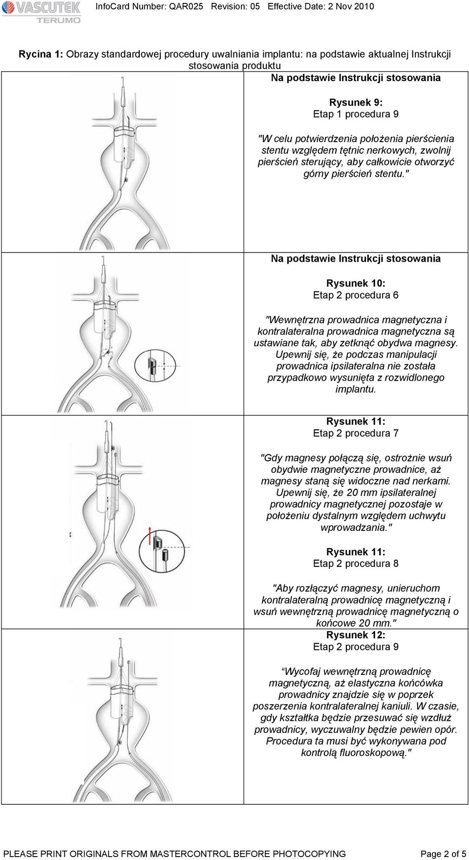 " Na podstawie Instrukcji stosowania Rysunek 10: Etap 2 procedura 6 "Wewnętrzna prowadnica magnetyczna i kontralateralna prowadnica magnetyczna są ustawiane tak, aby zetknąć obydwa magnesy.