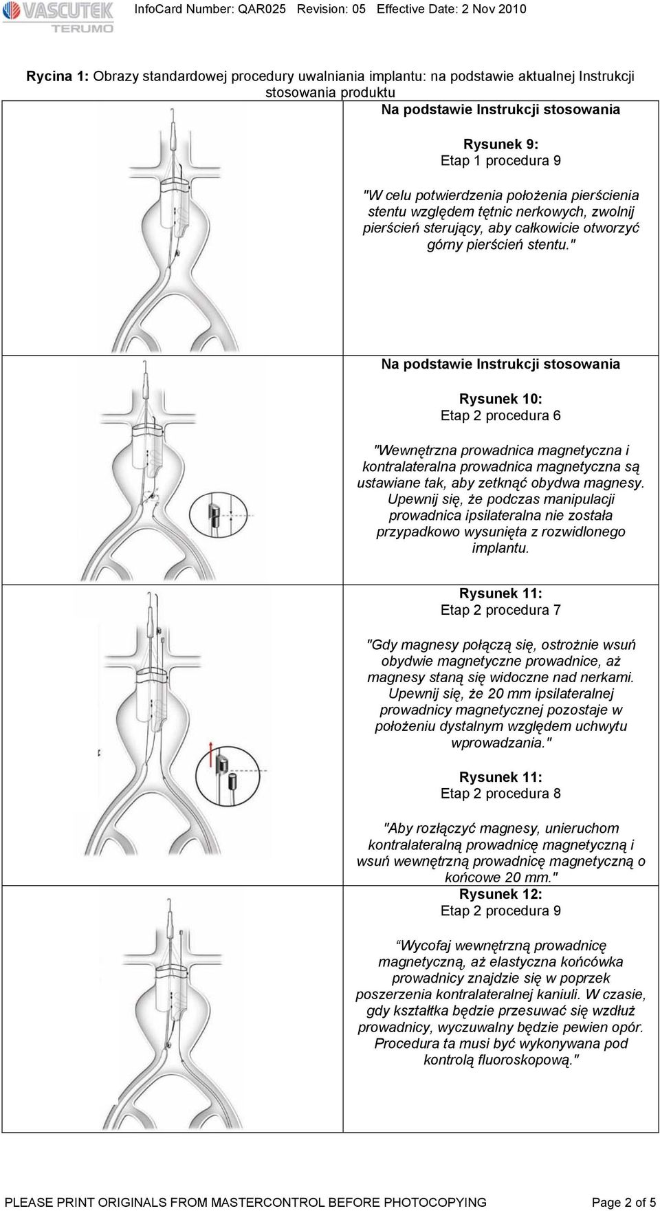 " Na podstawie Instrukcji stosowania Rysunek 10: Etap 2 procedura 6 "Wewnętrzna prowadnica magnetyczna i kontralateralna prowadnica magnetyczna są ustawiane tak, aby zetknąć obydwa magnesy.