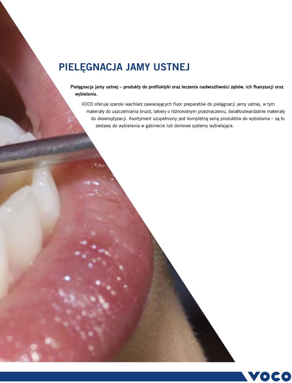 VOCO oferuje szeroki wachlarz zawierających fluor preparatów do pielęgnacji jamy ustnej, w tym materiały do uszczelniania