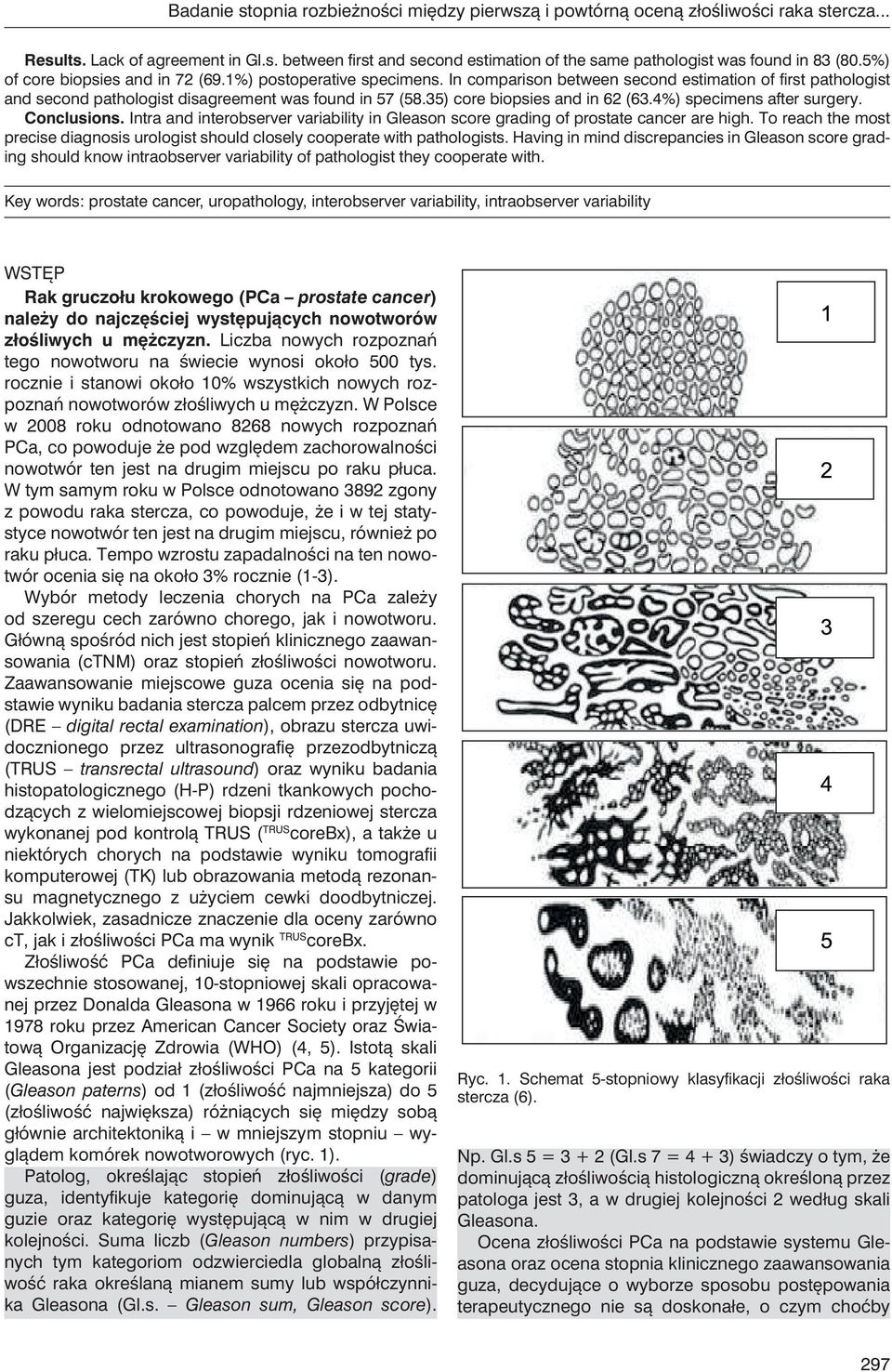 35) core biopsies and in 62 (63.4%) specimens after surgery. Conclusions. Intra and interobserver variability in Gleason score grading of prostate cancer are high.