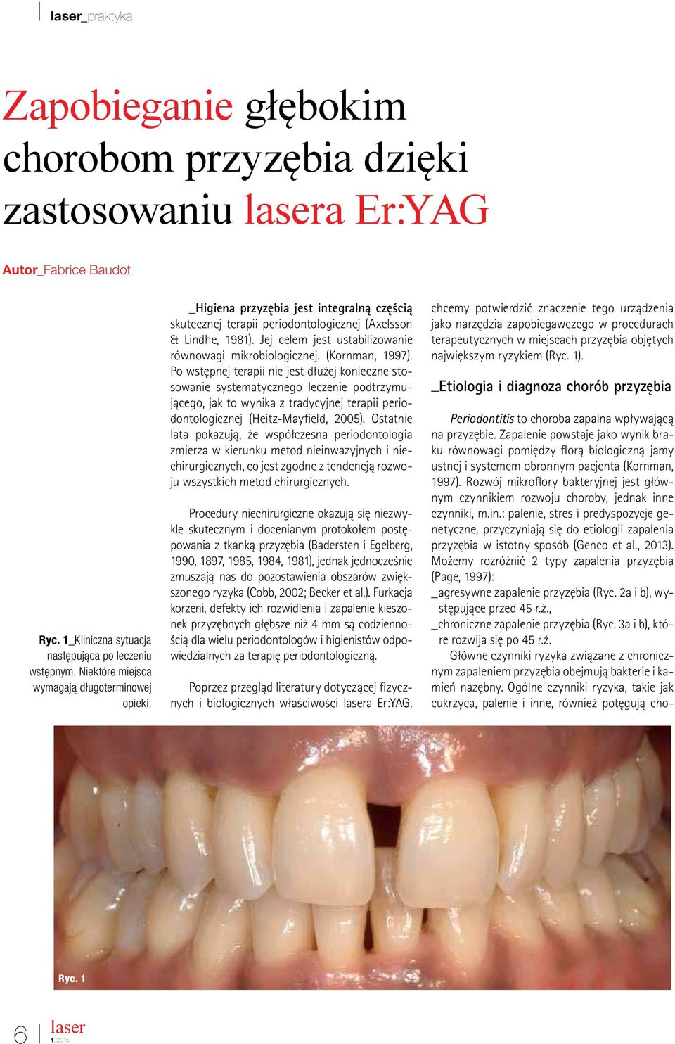 Jej celem jest ustabilizowanie równowagi mikrobiologicznej. (Kornman, 1997).