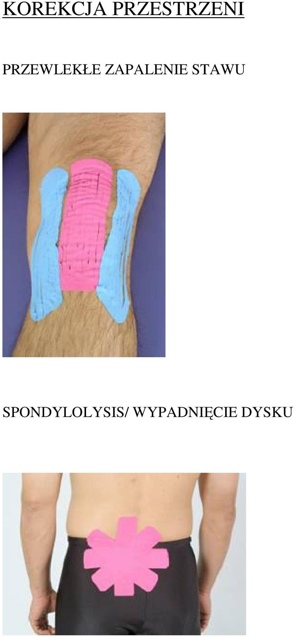 PRZEWLEKŁE