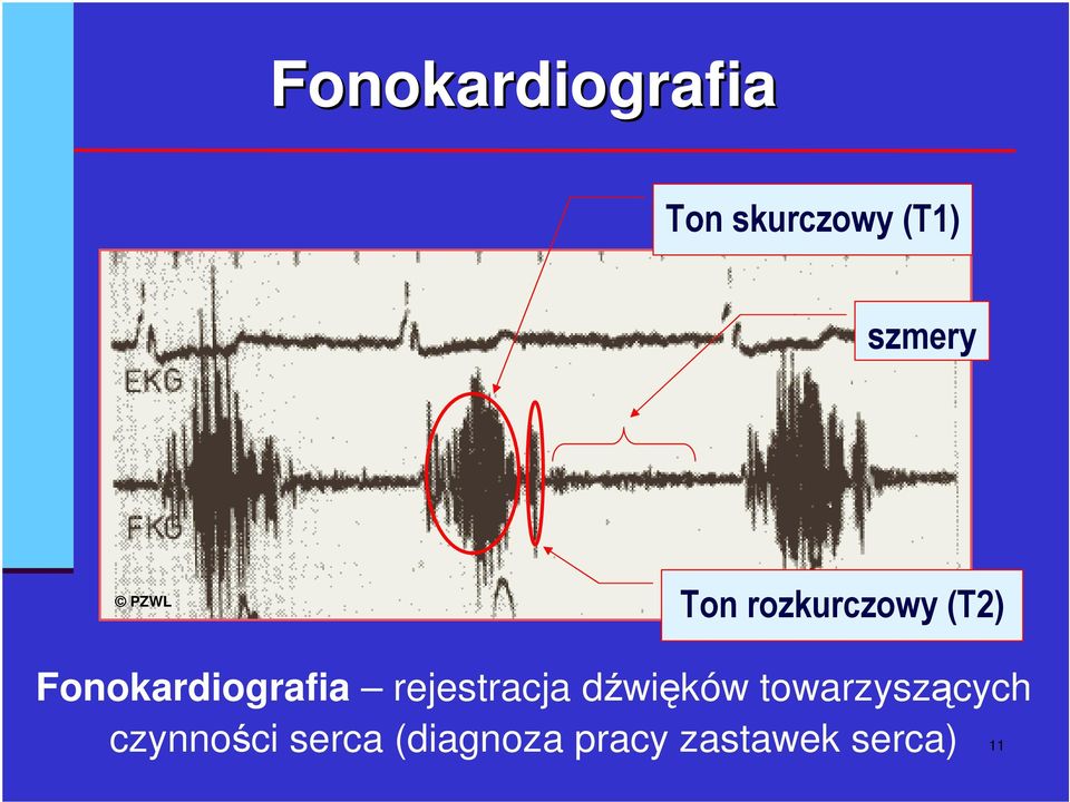 dwików towarzyszcych czynnoci