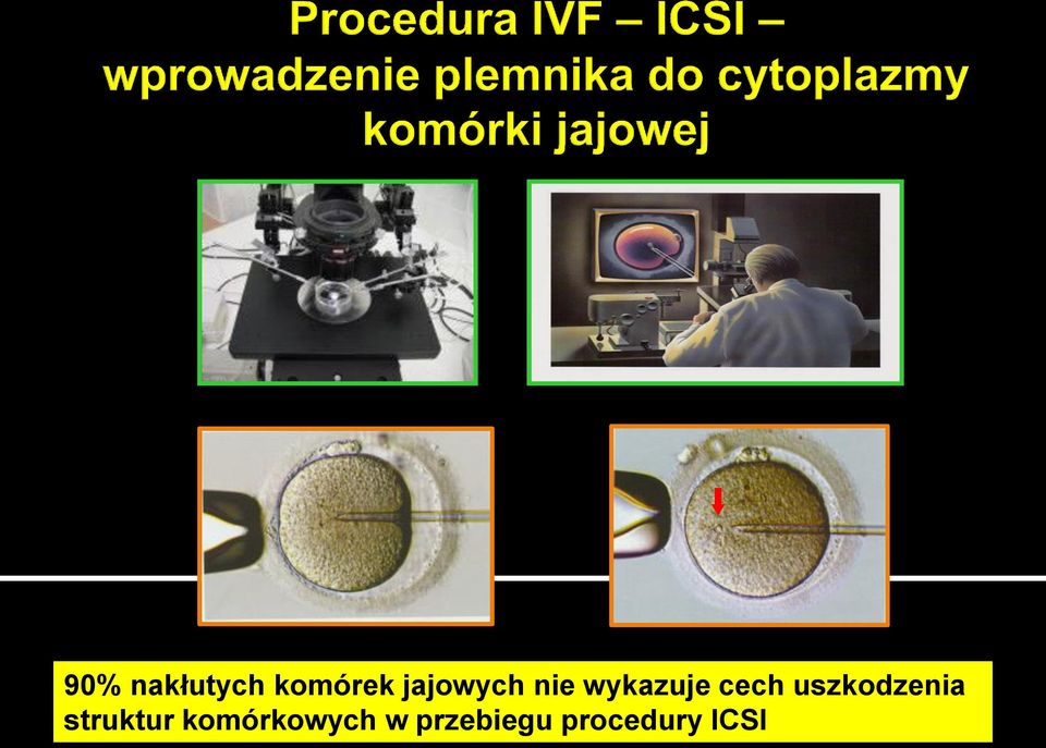 uszkodzenia struktur