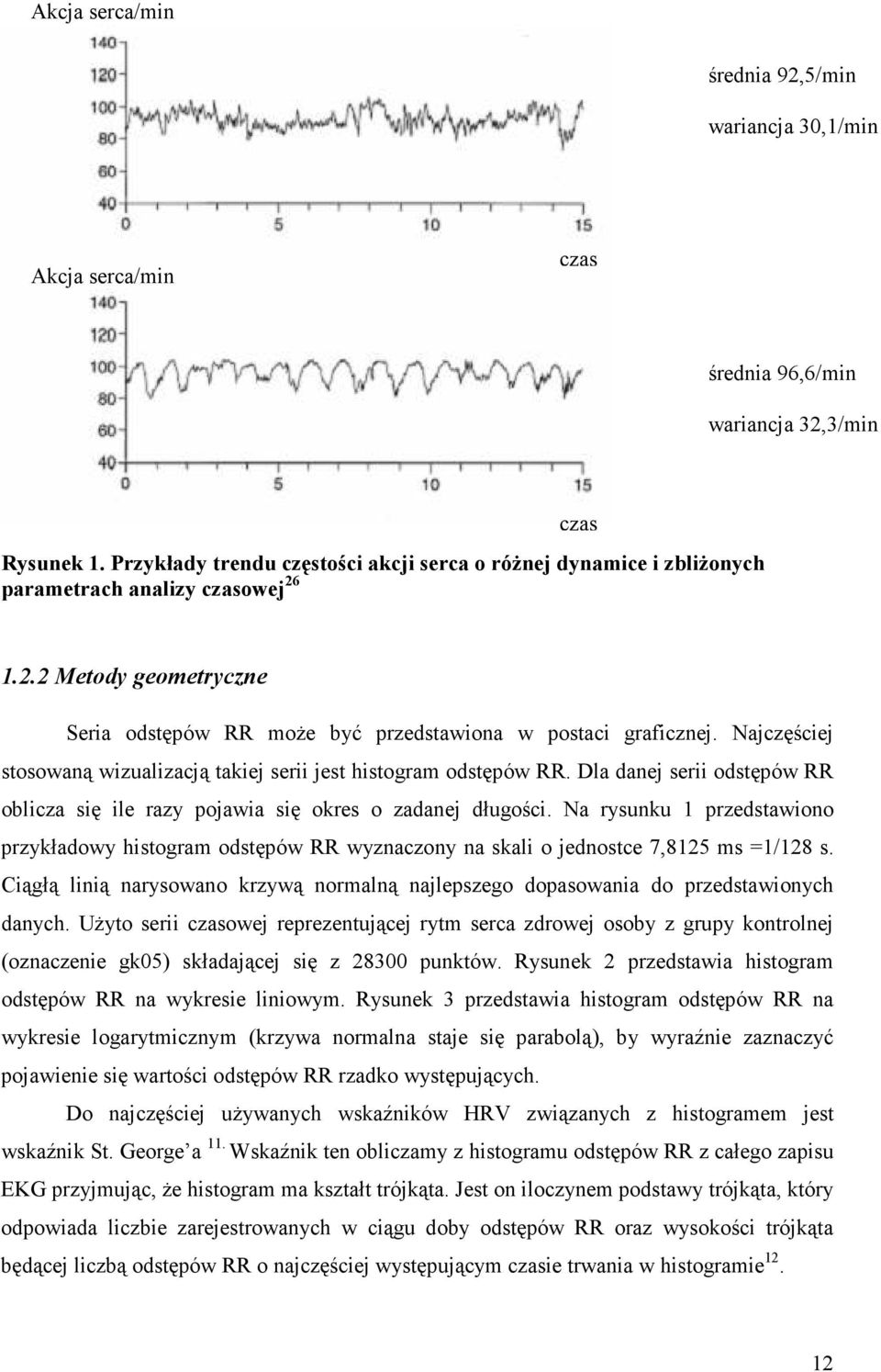 Najczęściej stosowaną wizualizacją takiej serii jest histogram odstępów RR. Dla danej serii odstępów RR oblicza się ile razy pojawia się okres o zadanej długości.