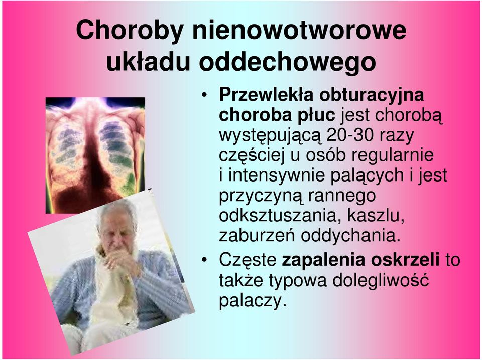 intensywnie palących i jest przyczyną rannego odksztuszania, kaszlu,