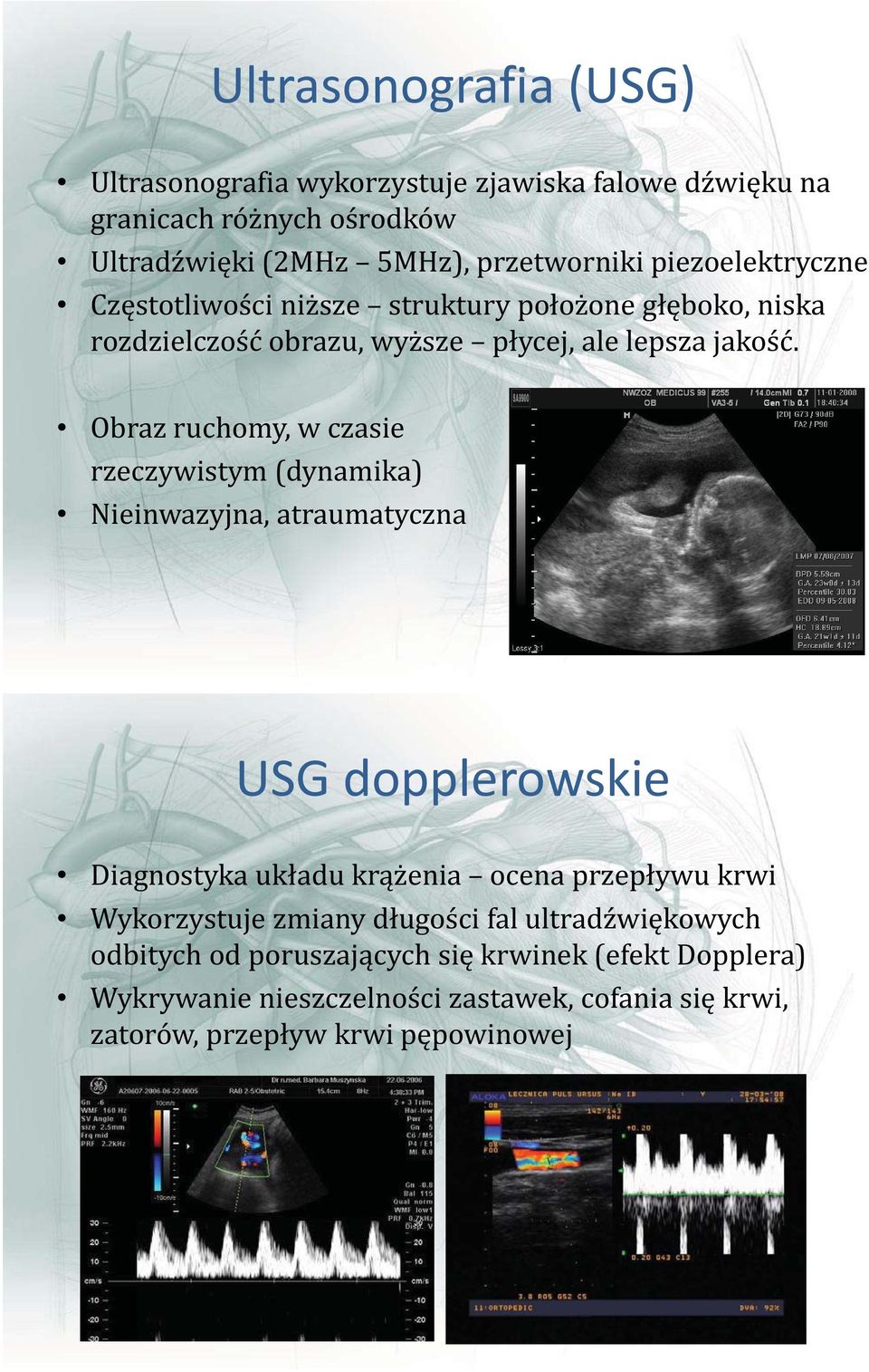 Obraz ruchomy, w czasie rzeczywistym (dynamika) Nieinwazyjna, atraumatyczna USG dopplerowskie Diagnostyka układu krążenia ocena przepływu krwi
