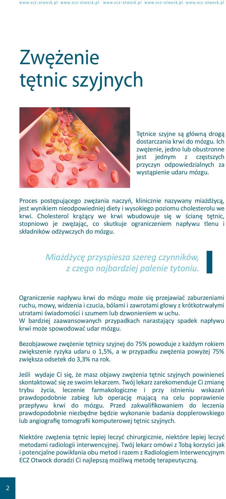 Cholesterol krążący we krwi wbudowuje się w ścianę tętnic, stopniowo je zwężając, co skutkuje ograniczeniem napływu tlenu i składników odżywczych do mózgu.