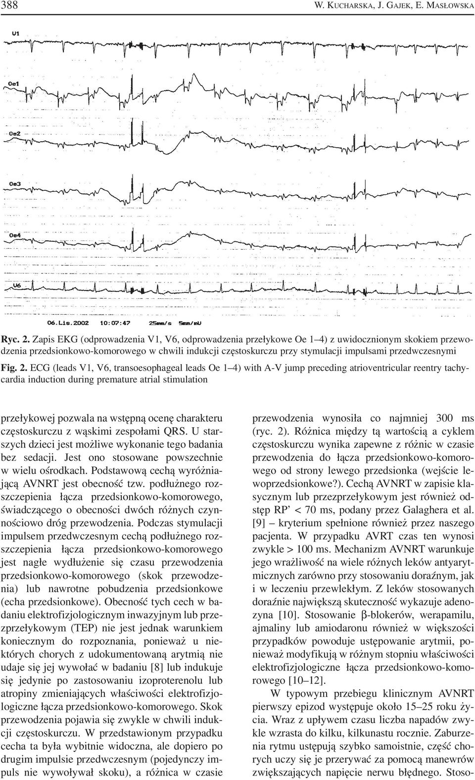 przedwczesnymi Fig. 2.