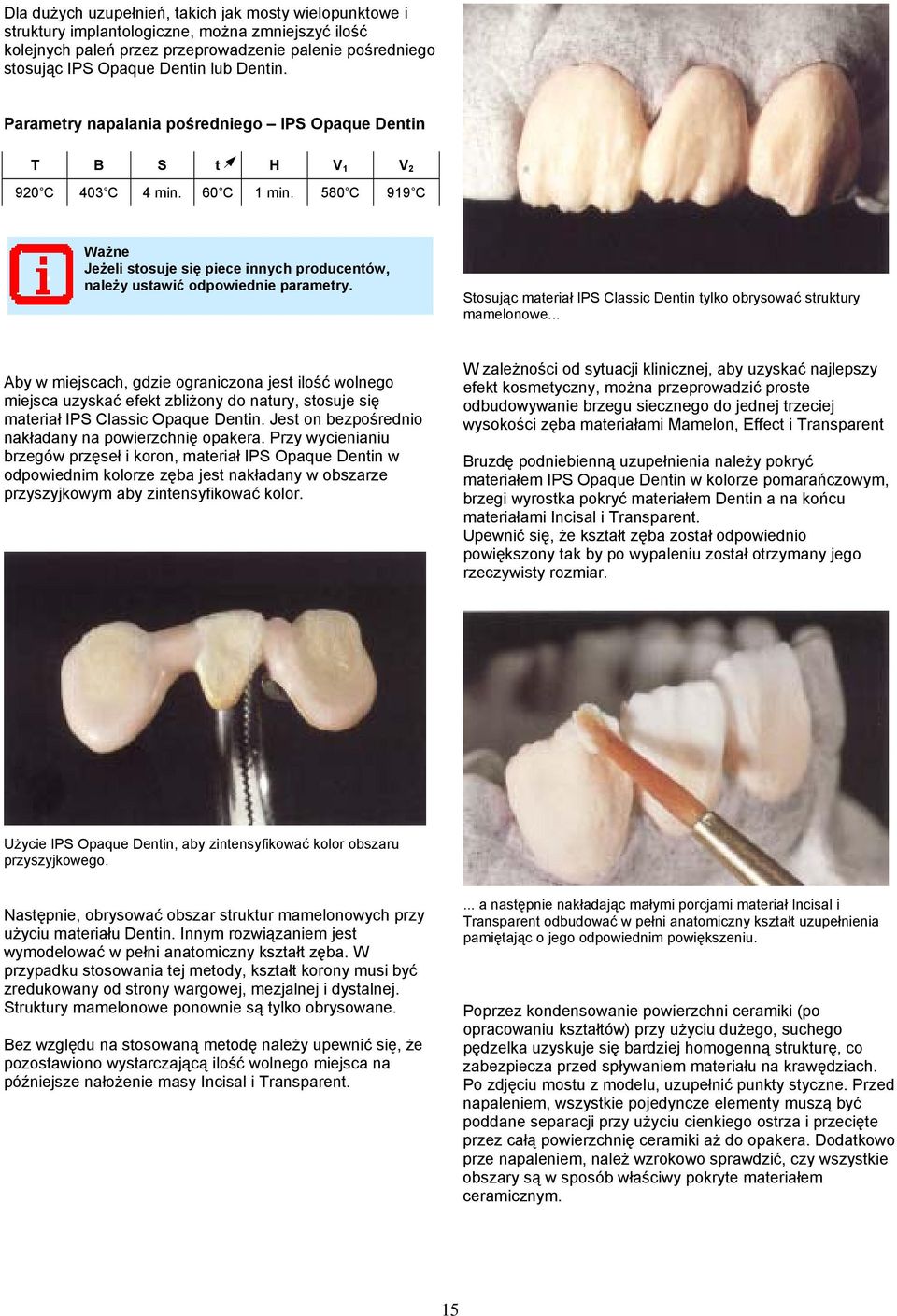 .. Aby w miejscach, gdzie ograniczona jest ilość wolnego miejsca uzyskać efekt zbliżony do natury, stosuje się materiał IPS Classic Opaque Dentin.