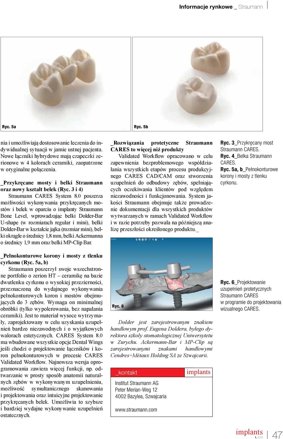 3 i 4) Straumann CARES System 8.