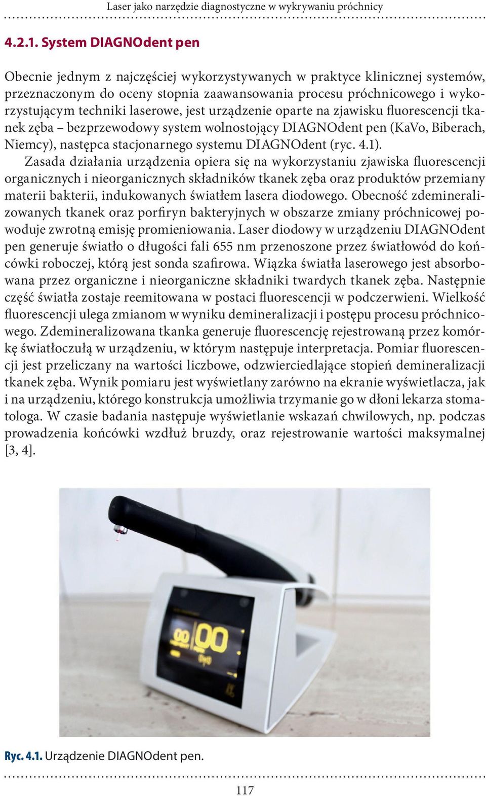laserowe, jest urządzenie oparte na zjawisku fluorescencji tkanek zęba bezprzewodowy system wolnostojący DIAGNOdent pen (KaVo, Biberach, Niemcy), następca stacjonarnego systemu DIAGNOdent (ryc. 4.1).