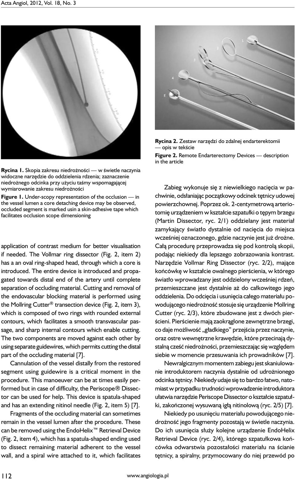 Under-scopy representation of the occlusion in the vessel lumen a core detaching device may be observed, occluded segment is marked usin a skin-adhesive tape which facilitates occlusion scope
