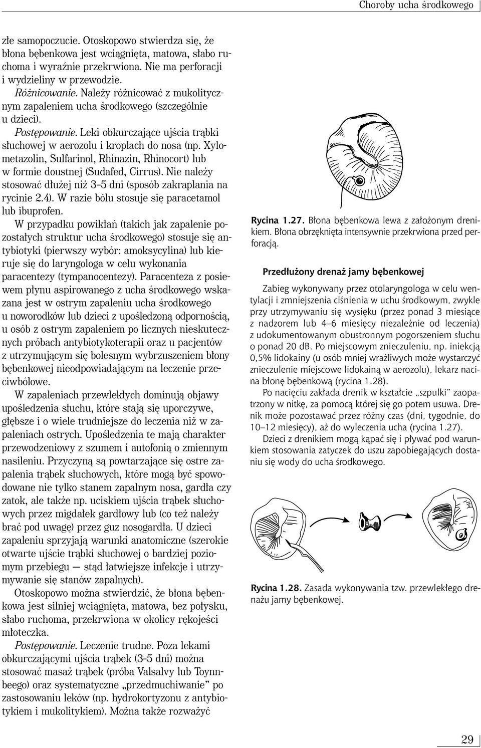 Xylometazolin, Sulfarinol, Rhinazin, Rhinocort) lub w formie doustnej (Sudafed, Cirrus). Nie nale y stosowaç d u ej ni 3 5 dni (sposób zakraplania na rycinie 2.4).