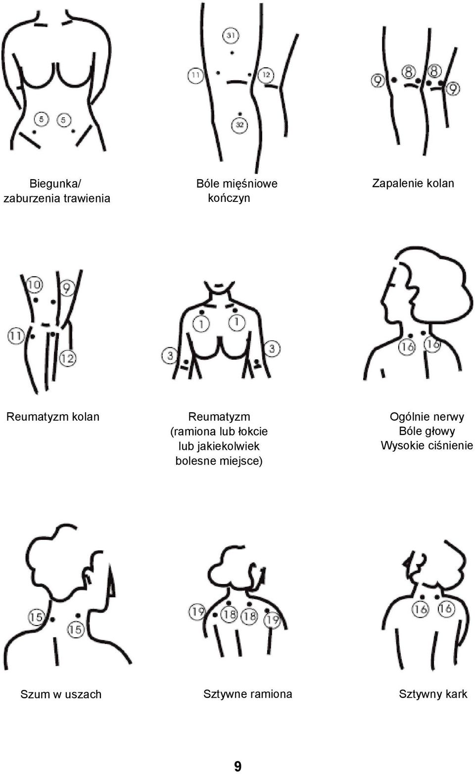 łokcie lub jakiekolwiek bolesne miejsce) Ogólnie nerwy Bóle