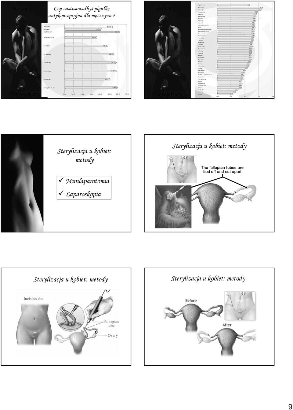 ŚWIAT Durex, 2005 Durex, 2005 Sterylizacja u kobiet: metody