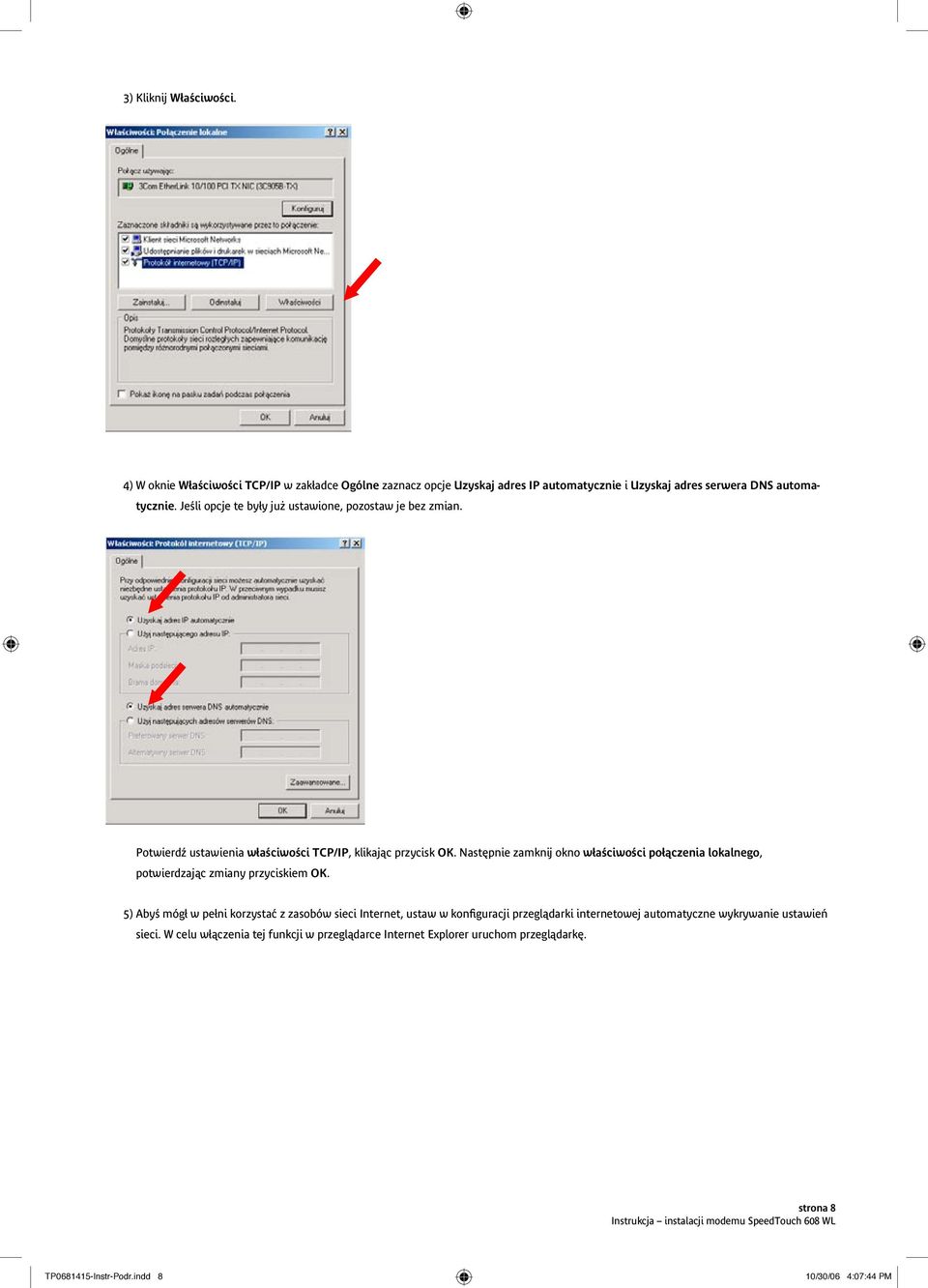 TCP/IP w zakładce Ogólne zaznacz opcje Uzyskaj 4) adres W oknie IPWłaściwości automatycznie TCP/IP i Uzyskaj w zakładce adres serwera Ogólne zaznacz DNS automatycznie.