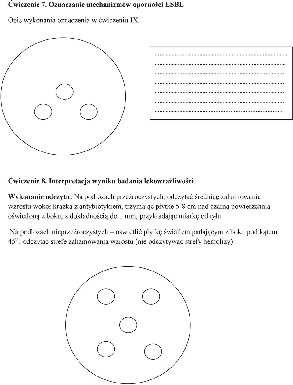 krążka z antybiotykiem, trzymając płytkę 5-8 cm nad czarną powierzchnią oświetloną z boku, z dokładnością do 1 mm, przykładając miarkę od