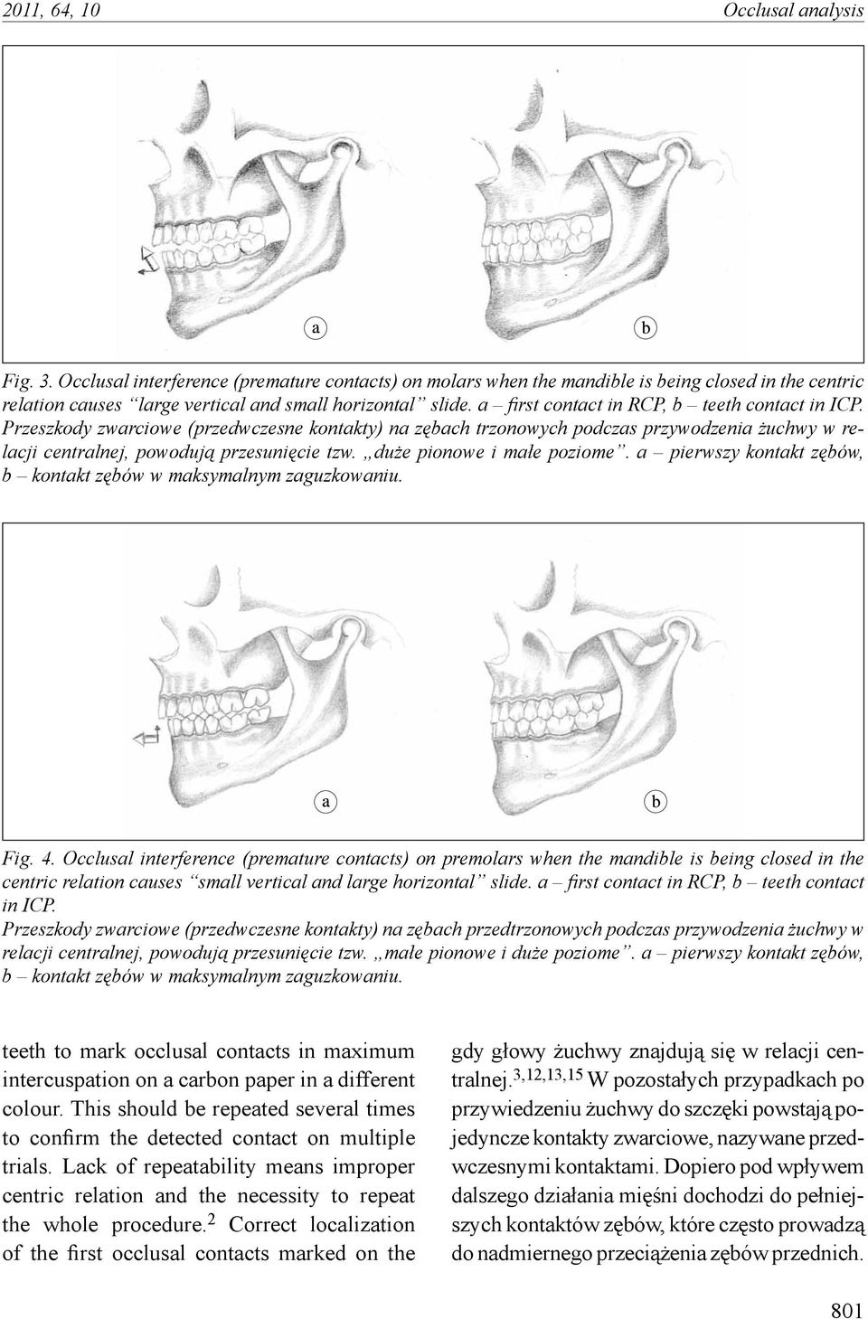 duże pionowe i małe poziome. a pierwszy kontakt zębów, b kontakt zębów w maksymalnym zaguzkowaniu. Fig. 4.